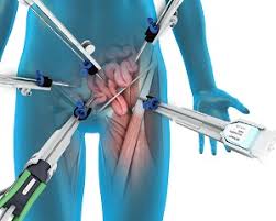 Robotic Repairs